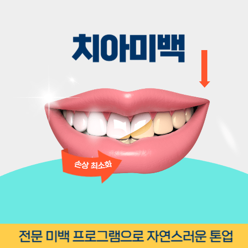익산치과 익산시 치과 치아미백