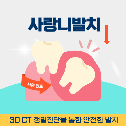 익산치과 익산시 치과 사랑니 발치