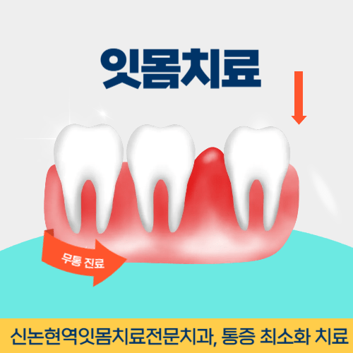 익산치과 익산시 치과 잇몸치료